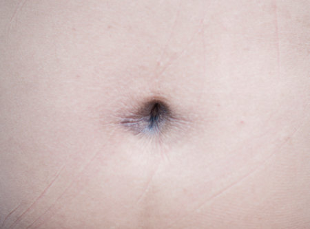Black stains and dirty body skin around the navelの写真素材