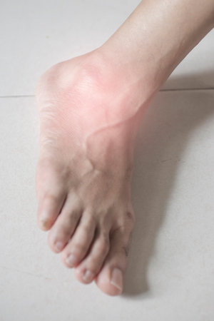 Muscles and bone joints in the ankles and legs of people with sprains, pain, and swelling.