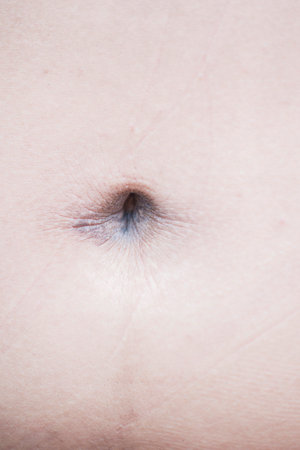 Stains of dirt on the skin around the navelの写真素材
