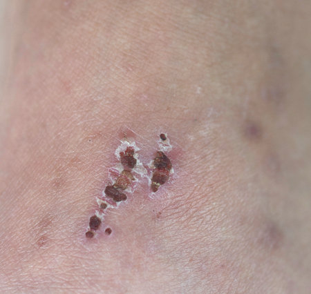 Scars on the skin that scab people