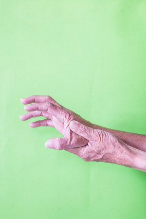 The muscles in the body have symptoms of peripheral neuropathy in the hands and fingers.の写真素材