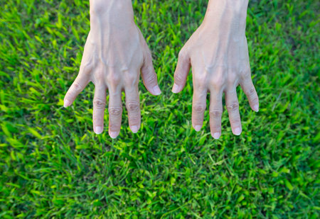 Numbness of hands and fingers, cramping musclesの写真素材