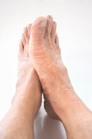 Feet with rough skin isolated on white background