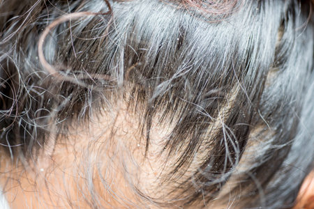 close up of woman's hair, hair loss problem, hair care concept