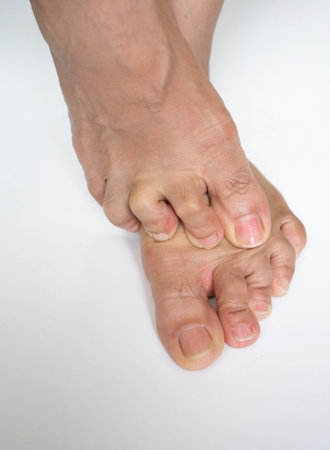 feet of a woman on a white background, closeup of photo