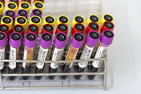 Blood in the tube for scientific experimentationの写真素材