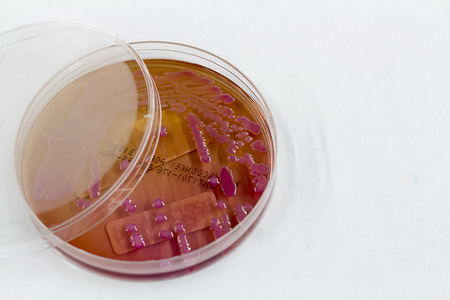 Bacteria in the culture mediumの写真素材