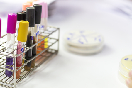 Laboratory experiments in the laboratoryの写真素材