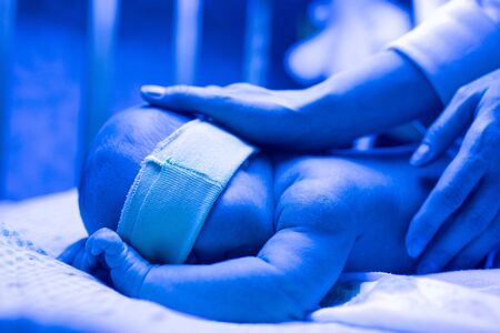 Newborn having a treatment for jaundice under ultraviolet lamp in home bedの写真素材