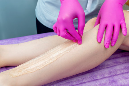 Woman having hair removal procedure on legs in a beauty salon