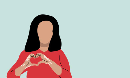 Woman with vitiligo, vector illustration. Woman with vitiligo shows a heart with her hands.のイラスト素材