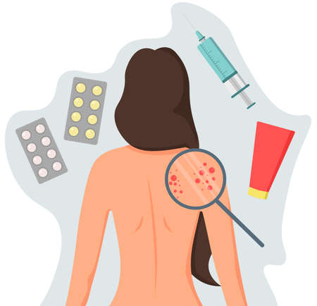 Problems with the skin of the back. Girl with a bare back with acne. Dermatologist appointment. Medicines for dermatitis, ointment for acne and fungus.のイラスト素材