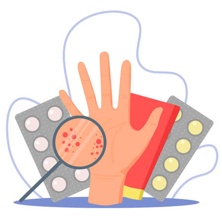Problems with the skin of the palms. Dermatologist, medicines for allergies, eczema or dermatosis. Palm with inflammation on a white backgroundのイラスト素材