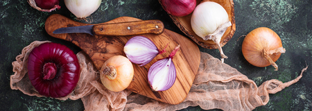 Various type of onions on green background.の写真素材