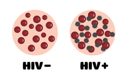 HIV in the blood. blood with and without HIV. blood of a person infected with HIV. blood under a microscope. World aids day. vector illustrationのイラスト素材