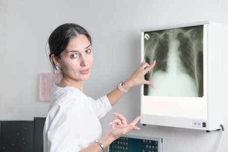 woman radiologist pointing to the screen with x-ray image of lungs and talking or discussing case with viewer. virus and lung disease sequelaeの写真素材