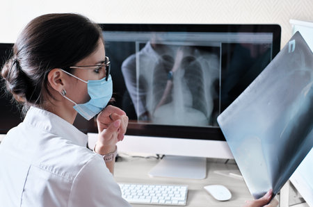 Asian woman doctor radiologist examining film x-ray image. Analyze a progress of lung disease....