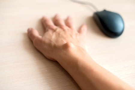 female hand with a hygroma. Pain. Wrist ganglion cyst. Treatment without surgery.