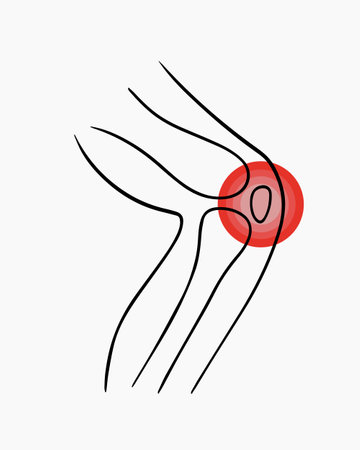 Vector isolated illustration of knee pain. Contour drawing of a human leg with pain in the joints.のイラスト素材
