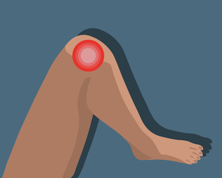 Vector isolated illustration of knee pain. Localization of knee pain.のイラスト素材