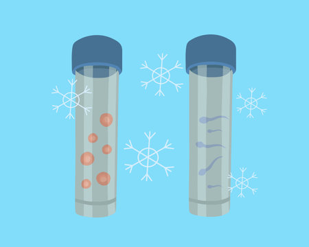 Vector isolated illustration of egg and sperm freezing. Cryopreservation of eggs and sperm. Reproductive clinic. Artificial insemination.のイラスト素材