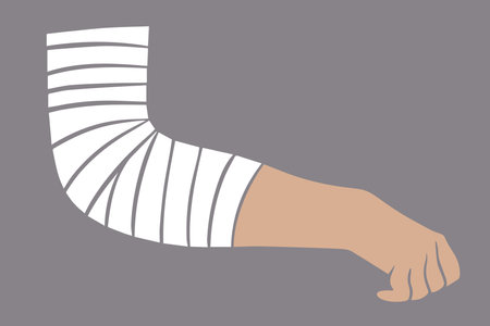 Vector illustration of elbow bandaging. First aid for elbow injuries.のイラスト素材