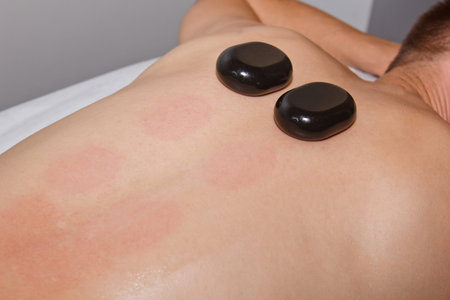 Wellness concept. Handsome young man relaxing under the stimulating effect of a traditional hot...