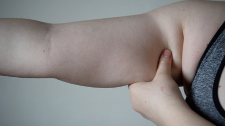 Close-up of fat folds on the large belly of an overweight woman. Concept of overweight, female obesity, dieting and overweight problems.の写真素材