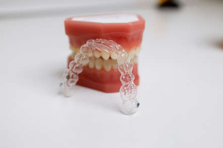 mouth guard and models of teeth on a jawの写真素材