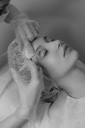 Black and white photo of woman with fair skin receiving botox injections during a cosmetic procedureの写真素材