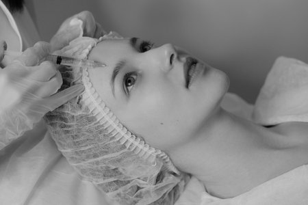 Black and white photo of woman with fair skin receiving botox injections during a cosmetic procedureの写真素材