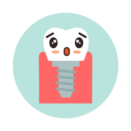 dental implant. dental restorations. Tooth with screwsのイラスト素材