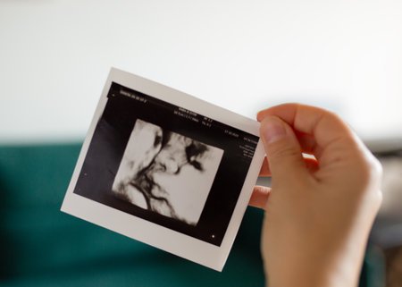 Ultrasound picture in hand of a pregnant woman.の写真素材