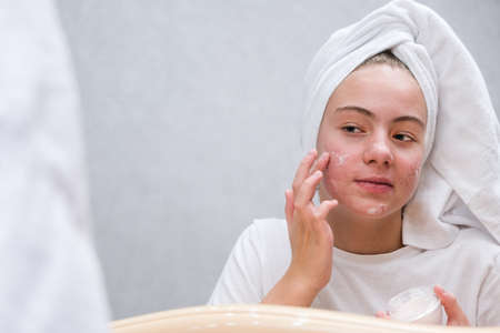 acne. A teenage girl applying cream to the problematic skinの写真素材