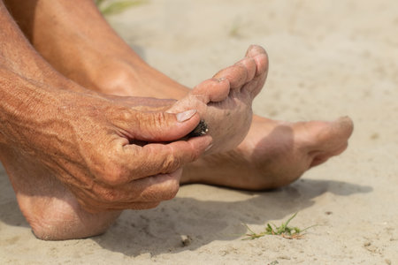 A man takes a dry thorn out of his foot. The problem of trash on the beach caused by man-made pollution and environmental in concept.の写真素材