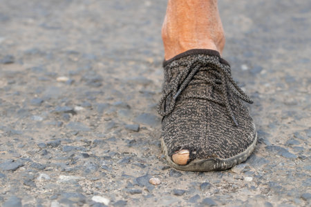 Men's worn-out shoes with a hole on the toes.の写真素材