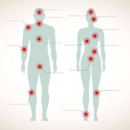 Pain infographic. Human silhouette of man and woman figure body with migraine and belly hurt painful symbols vectorのイラスト素材