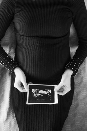 pregnant woman in a black dress lies on the bed with a snapshotの写真素材