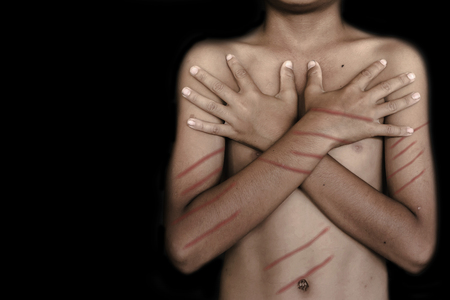 boy naked with bruises on body after beating, on black background with black shadowの写真素材