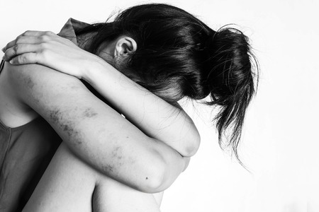 a woman sitting on ground with arm around lower head, bruises on body, Sexual violence , sexual abuse, human trafficking  in white toneの写真素材