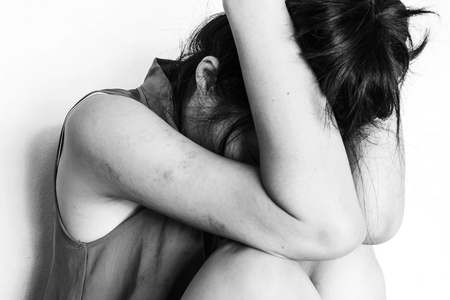 a woman sitting on ground with arm around lower head, bruises on body, Sexual violence , sexual abuse, human trafficking  in white toneの写真素材