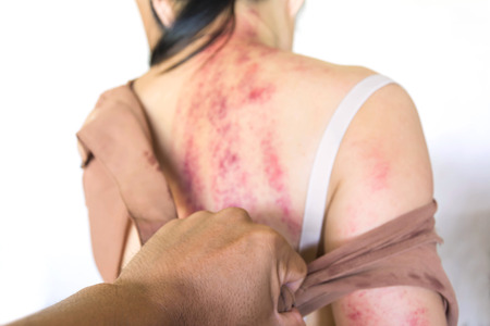 a man harshly woman's cloth with bruises on body, Sexual violence , sexual abuse,human traffickingの写真素材