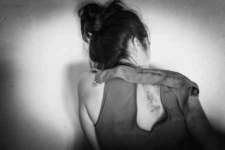 bruises on body, Sexual violence , sexual abuse, human trafficking with shadow edge in white toneの写真素材