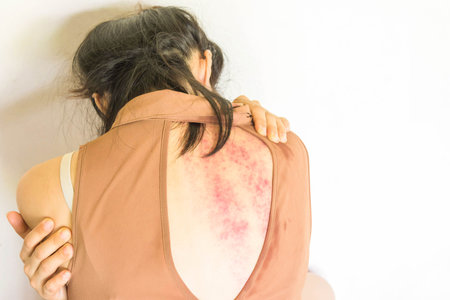 a woman sitting on ground with arm around body with lower head, bruises on body, Sexual violence ,...