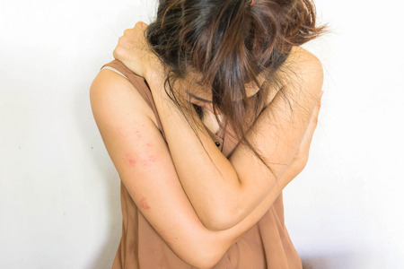 a woman sitting on ground with arm around body with lower head, bruises on body, Sexual violence , sexual abuse, human trafficking on whiteの写真素材