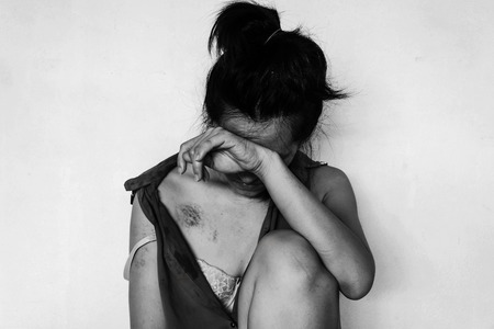 a woman sitting on ground with lower head, bruises on body, Sexual violence , sexual abuse, human trafficking in white toneの写真素材