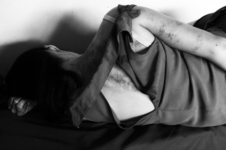 a woman laying on ground with arm around lower head, bruises on body, Sexual violence , sexual abuse, human trafficking  in white toneの写真素材