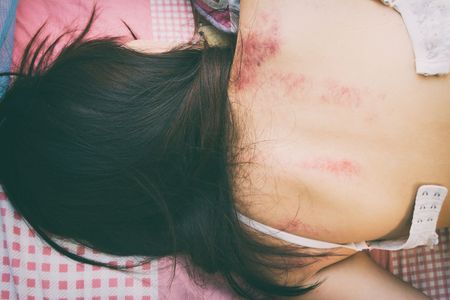 woman laying on bed with fear and  lower head, bruises on body, Sexual violence , sexual abuse, human trafficking with shadow edge  and black shadowの写真素材