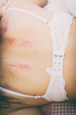 woman laying on bed with fear and  lower head, bruises on body, Sexual violence , sexual abuse, human trafficking with shadow edge and black shadowの写真素材