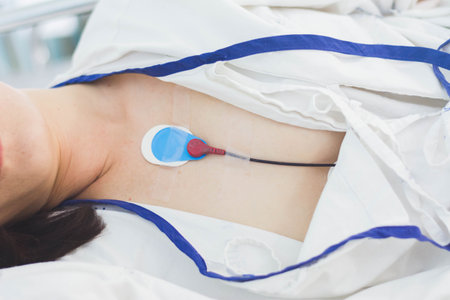 patient wearing holter monitor device for monitoring of an electrocardiogram 24 hour Heart...